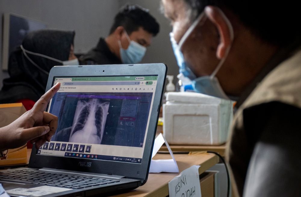 Lonjakan Kasus Tuberkulosis di Mimika pada Semester I 2026